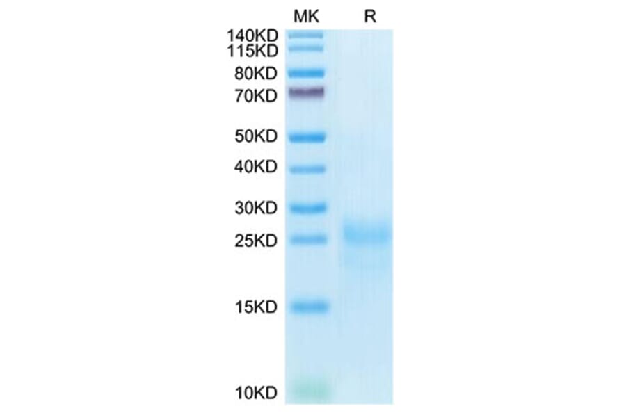 Tris-Bis PAGE - Recombinant Cynomolgus macaque CTLA4 Protein (C-terminal His Tag) (A331541) - Antibodies.com