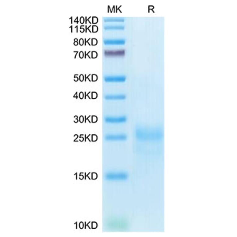 Tris-Bis PAGE - Recombinant Cynomolgus macaque CTLA4 Protein (C-terminal His Tag) (A331541) - Antibodies.com