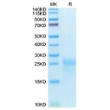 Tris-Bis PAGE - Recombinant Cynomolgus macaque CTLA4 Protein (C-terminal His Tag) (A331541) - Antibodies.com