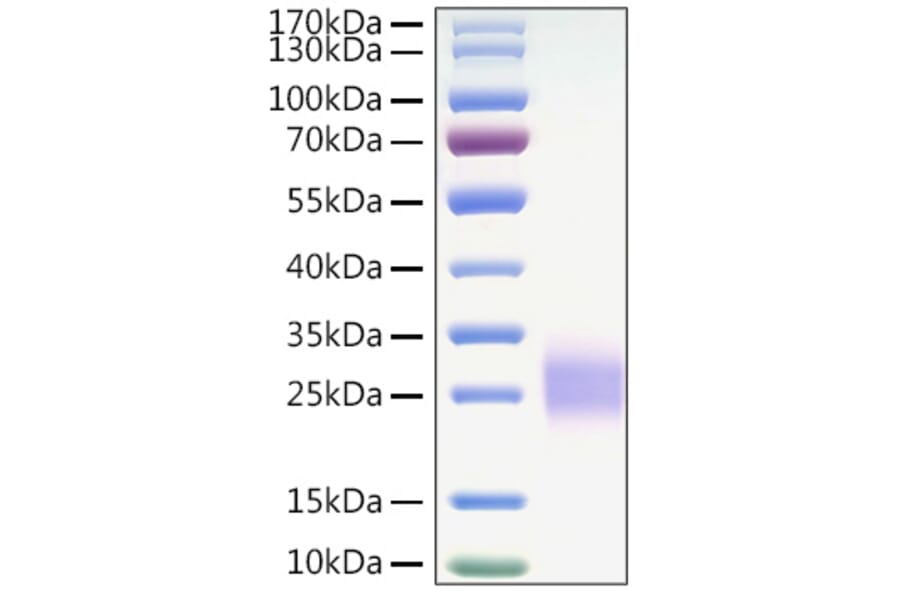SDS-PAGE - Recombinant Mouse CTLA4 Protein (C-terminal His Tag) (A331542) - Antibodies.com