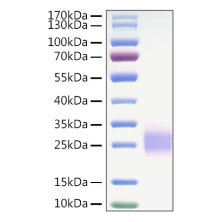 SDS-PAGE - Recombinant Mouse CTLA4 Protein (C-terminal His Tag) (A331542) - Antibodies.com