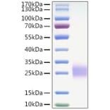 SDS-PAGE - Recombinant Mouse CTLA4 Protein (C-terminal His Tag) (A331542) - Antibodies.com