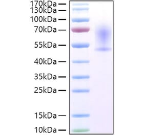 SDS-PAGE - Recombinant Mouse CX3CL1 Protein (C-terminal His Tag) (A331543) - Antibodies.com