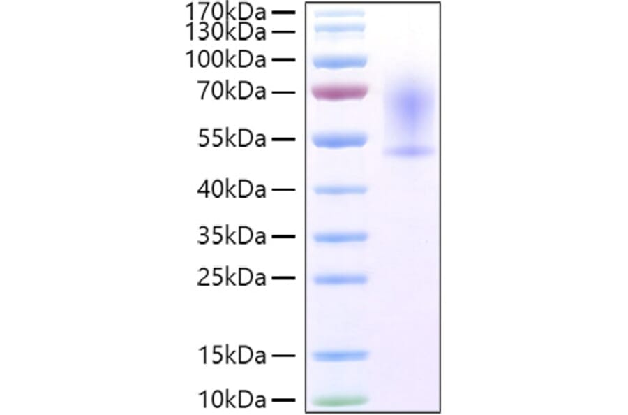 SDS-PAGE - Recombinant Mouse CX3CL1 Protein (C-terminal His Tag) (A331543) - Antibodies.com