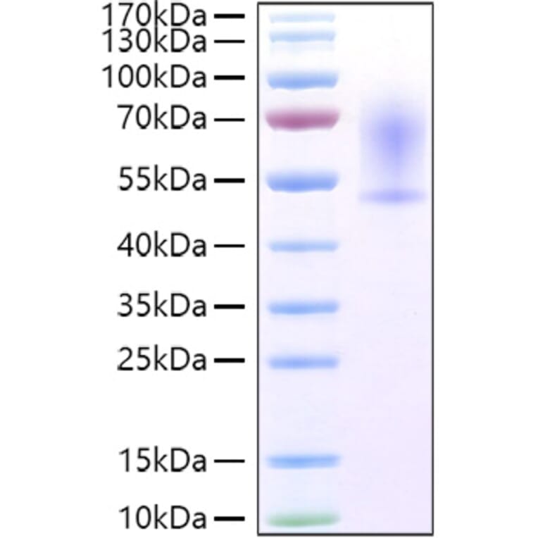 SDS-PAGE - Recombinant Mouse CX3CL1 Protein (C-terminal His Tag) (A331543) - Antibodies.com