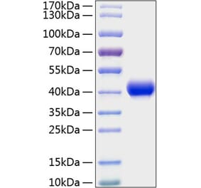 SDS-PAGE - Recombinant Mouse CXCL16 Protein (C-terminal His Tag) (A331549) - Antibodies.com