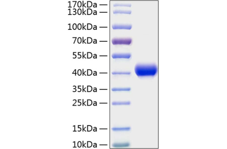 SDS-PAGE - Recombinant Mouse CXCL16 Protein (C-terminal His Tag) (A331549) - Antibodies.com