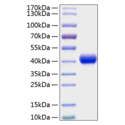 SDS-PAGE - Recombinant Mouse CXCL16 Protein (C-terminal His Tag) (A331549) - Antibodies.com