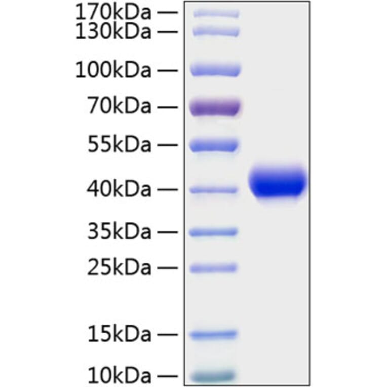 SDS-PAGE - Recombinant Mouse CXCL16 Protein (C-terminal His Tag) (A331549) - Antibodies.com