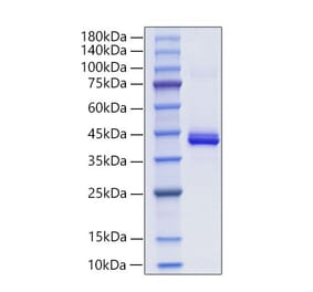 SDS-PAGE - Recombinant Mouse PF4 Protein (C-terminal Human Fc Tag) (A331551) - Antibodies.com