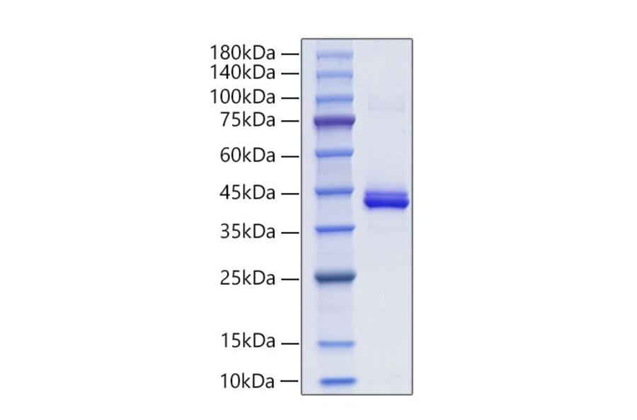 SDS-PAGE - Recombinant Mouse PF4 Protein (C-terminal Human Fc Tag) (A331551) - Antibodies.com