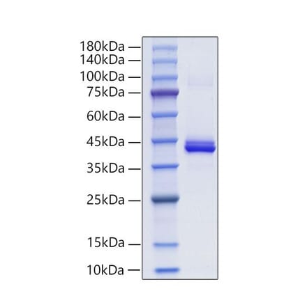 SDS-PAGE - Recombinant Mouse PF4 Protein (C-terminal Human Fc Tag) (A331551) - Antibodies.com
