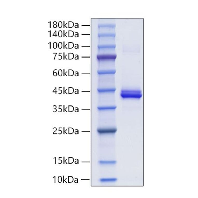 SDS-PAGE - Recombinant Mouse PF4 Protein (C-terminal Human Fc Tag) (A331551) - Antibodies.com