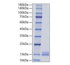 SDS-PAGE - Recombinant Mouse PF4 Protein (C-terminal His Tag) (A331552) - Antibodies.com