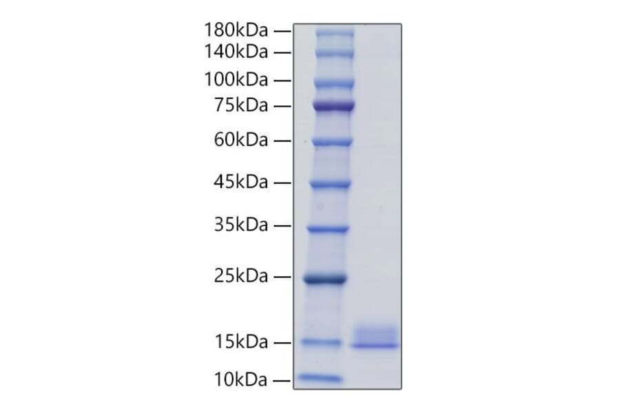 SDS-PAGE - Recombinant Mouse PF4 Protein (C-terminal His Tag) (A331552) - Antibodies.com