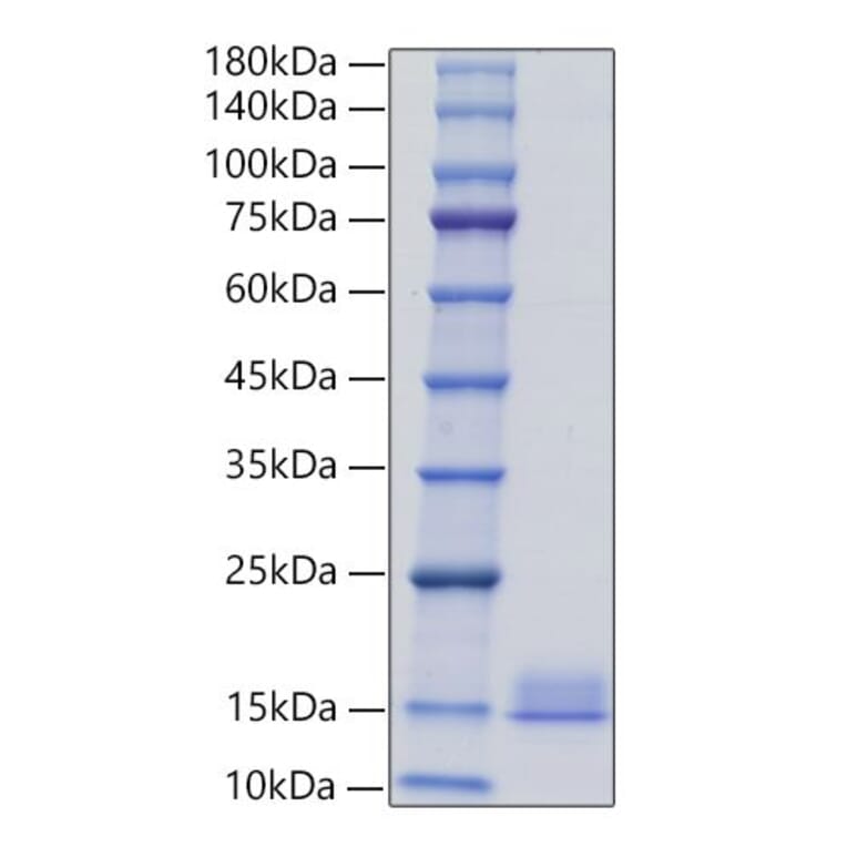 SDS-PAGE - Recombinant Mouse PF4 Protein (C-terminal His Tag) (A331552) - Antibodies.com