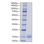 SDS-PAGE - Recombinant Mouse PF4 Protein (C-terminal His Tag) (A331552) - Antibodies.com