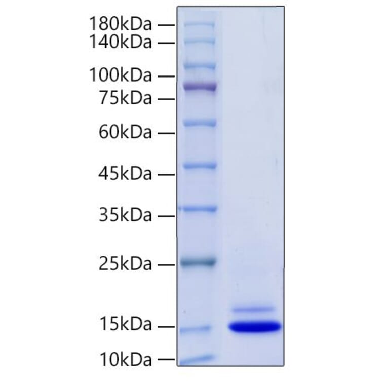 SDS-PAGE - Recombinant Mouse PF4 Protein (C-terminal His Tag) (A331553) - Antibodies.com