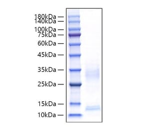 SDS-PAGE - Recombinant Mouse CXCL9 Protein (C-terminal His Tag) (A331554) - Antibodies.com