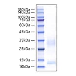 SDS-PAGE - Recombinant Mouse CXCL9 Protein (C-terminal His Tag) (A331554) - Antibodies.com