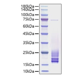 SDS-PAGE - Recombinant Rat Cystatin C Protein (C-terminal His Tag) (A331555) - Antibodies.com