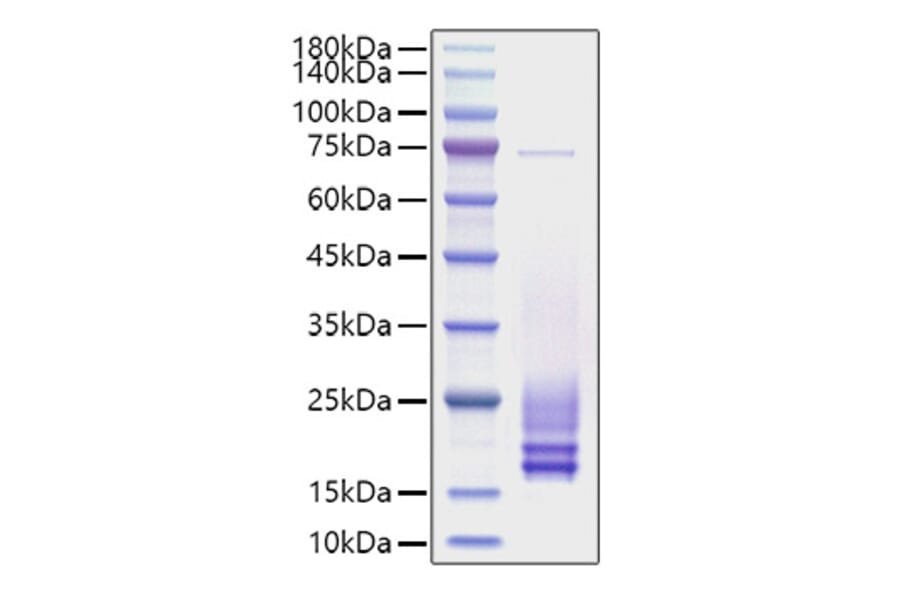 SDS-PAGE - Recombinant Rat Cystatin C Protein (C-terminal His Tag) (A331555) - Antibodies.com
