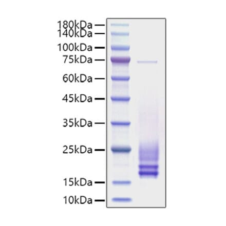 SDS-PAGE - Recombinant Rat Cystatin C Protein (C-terminal His Tag) (A331555) - Antibodies.com