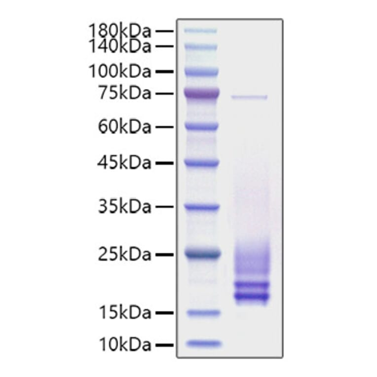 SDS-PAGE - Recombinant Rat Cystatin C Protein (C-terminal His Tag) (A331555) - Antibodies.com