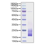 SDS-PAGE - Recombinant Rat Cystatin C Protein (C-terminal His Tag) (A331555) - Antibodies.com