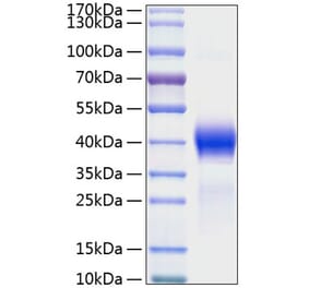 SDS-PAGE - Recombinant Mouse DKK1 Protein (C-terminal His Tag) (A331557) - Antibodies.com