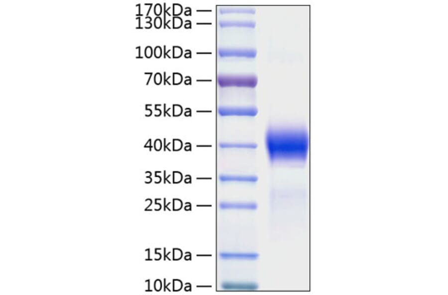 SDS-PAGE - Recombinant Mouse DKK1 Protein (C-terminal His Tag) (A331557) - Antibodies.com