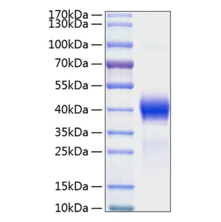 SDS-PAGE - Recombinant Mouse DKK1 Protein (C-terminal His Tag) (A331557) - Antibodies.com