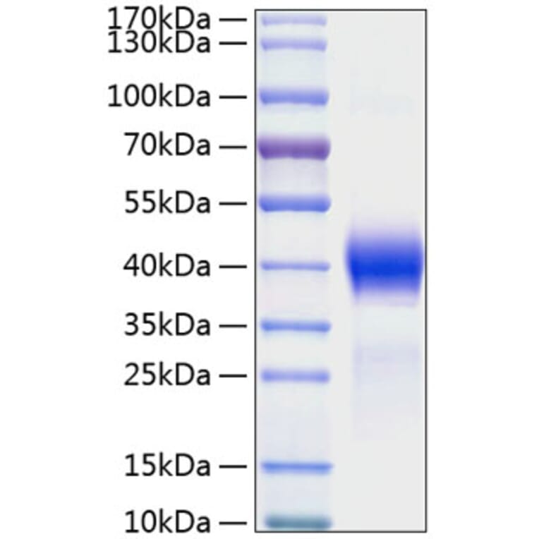 SDS-PAGE - Recombinant Mouse DKK1 Protein (C-terminal His Tag) (A331557) - Antibodies.com
