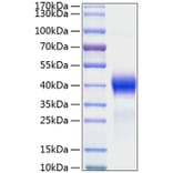 SDS-PAGE - Recombinant Mouse DKK1 Protein (C-terminal His Tag) (A331557) - Antibodies.com