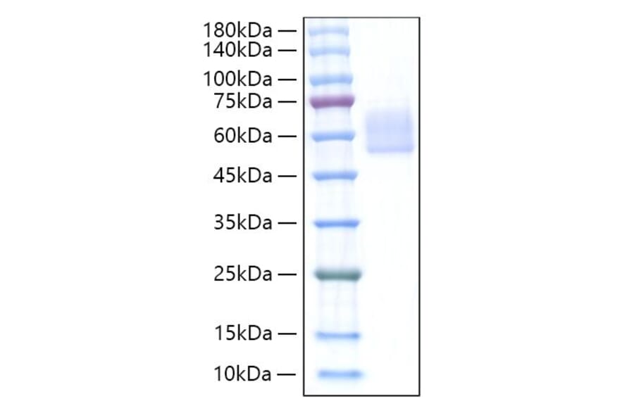 SDS-PAGE - Recombinant Mouse DKK3 Protein (C-terminal His Tag) (A331558) - Antibodies.com
