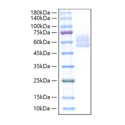 SDS-PAGE - Recombinant Mouse DKK3 Protein (C-terminal His Tag) (A331558) - Antibodies.com