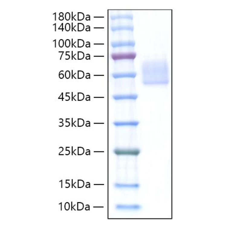 SDS-PAGE - Recombinant Mouse DKK3 Protein (C-terminal His Tag) (A331558) - Antibodies.com