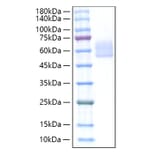 SDS-PAGE - Recombinant Mouse DKK3 Protein (C-terminal His Tag) (A331558) - Antibodies.com
