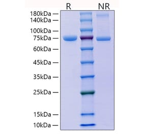 SDS-PAGE - Recombinant Mouse E Cadherin Protein (C-terminal His Tag) (A331559) - Antibodies.com