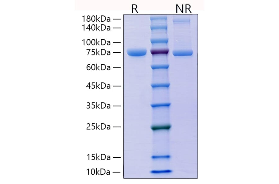SDS-PAGE - Recombinant Mouse E Cadherin Protein (C-terminal His Tag) (A331559) - Antibodies.com