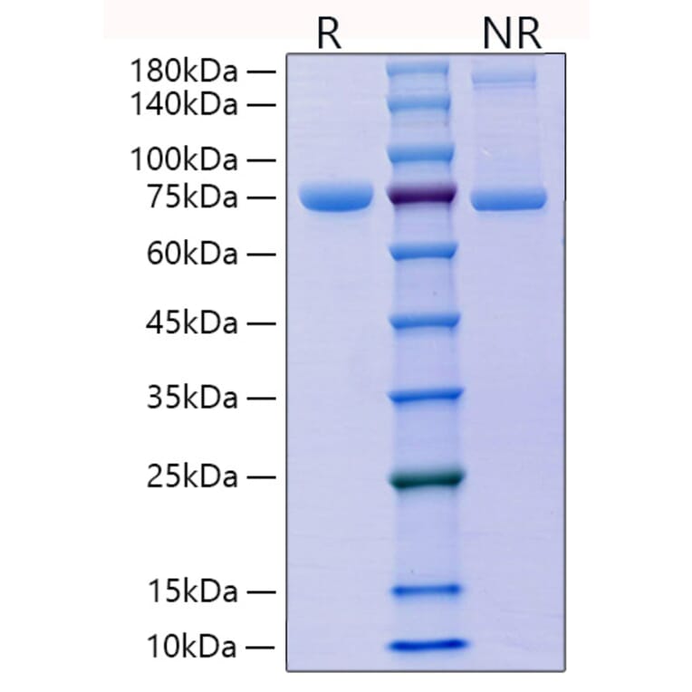 SDS-PAGE - Recombinant Mouse E Cadherin Protein (C-terminal His Tag) (A331559) - Antibodies.com