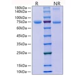 SDS-PAGE - Recombinant Mouse E Cadherin Protein (C-terminal His Tag) (A331559) - Antibodies.com
