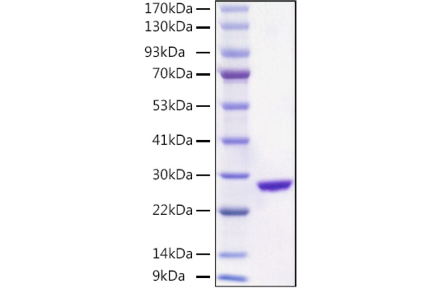 SDS-PAGE - Recombinant Aequorea victoria EGFP Protein (C-terminal His Tag) (A331560) - Antibodies.com