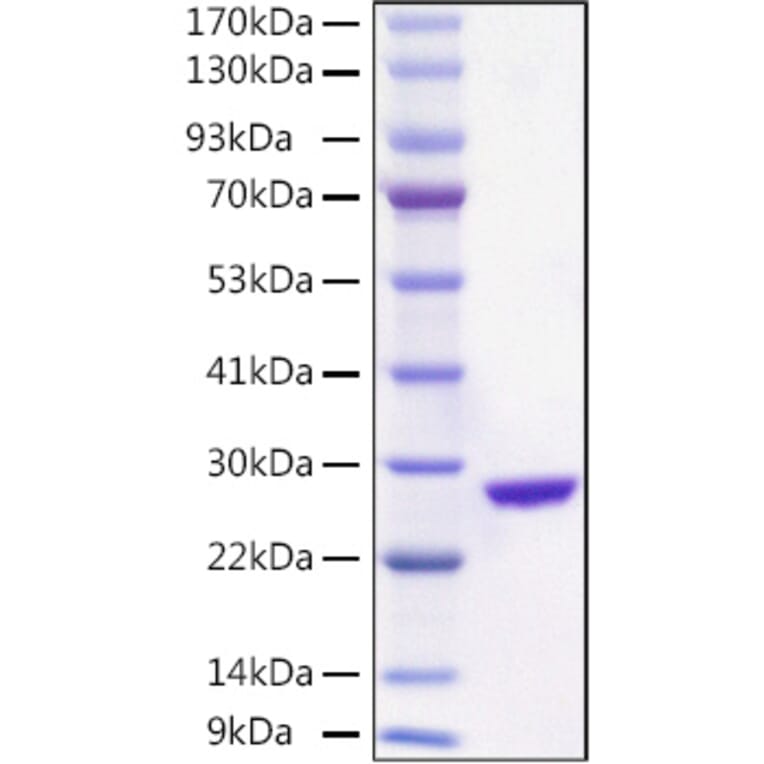 SDS-PAGE - Recombinant Aequorea victoria EGFP Protein (C-terminal His Tag) (A331560) - Antibodies.com