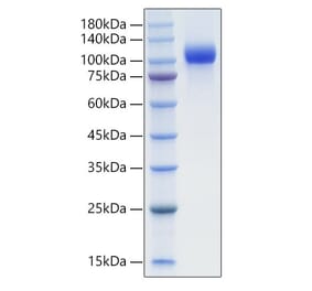 SDS-PAGE - Recombinant Mouse EGFR Protein (C-terminal His Tag) (A331561) - Antibodies.com