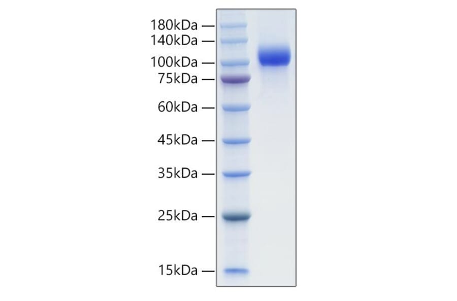 SDS-PAGE - Recombinant Mouse EGFR Protein (C-terminal His Tag) (A331561) - Antibodies.com