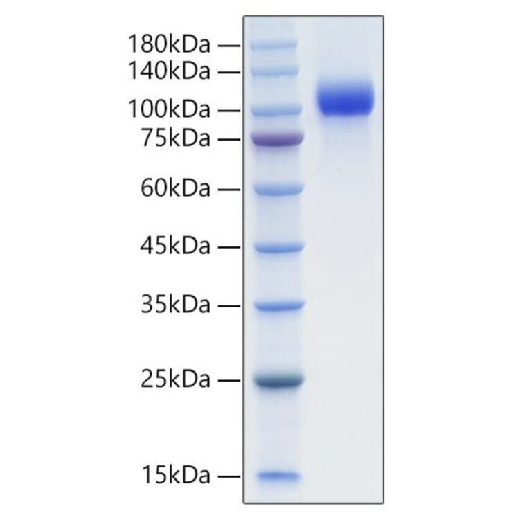 SDS-PAGE - Recombinant Mouse EGFR Protein (C-terminal His Tag) (A331561) - Antibodies.com