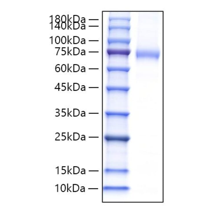 SDS-PAGE - Recombinant Mouse CD105 Protein (C-terminal His Tag) (A331562) - Antibodies.com