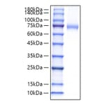 SDS-PAGE - Recombinant Mouse CD105 Protein (C-terminal His Tag) (A331562) - Antibodies.com