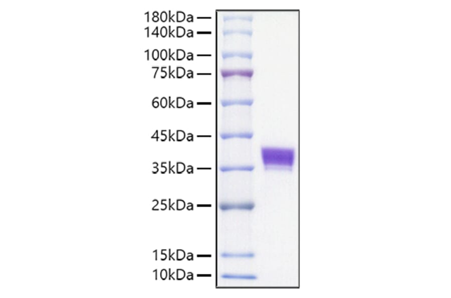 SDS-PAGE - Recombinant Mouse EpCAM Protein (C-terminal His Tag) (A331563) - Antibodies.com